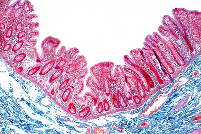 Gut biome seen through a microscope