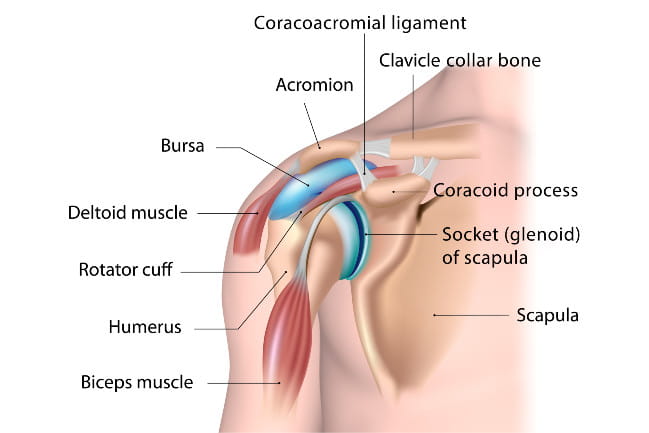 The anatomy of the shoulder showing the coracoacromial ligament, acromion, bursa, deltoid muscle, rotator cuff, humerus, biceps, clavicle, coacoid process, socket (glenoid) of scapula, and scapula.