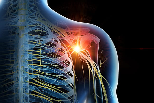 Illustration of nerves in the shoulder